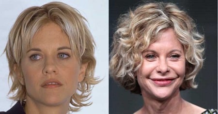 A picture of Meg Ryan before (left) and after (right).